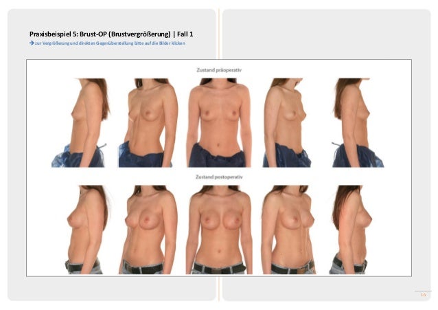 VorherNachherBilder in der Plastischen und Ästhetischen Chirurgie